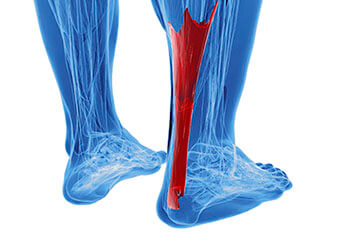 achilles tendon treatment in the Cherokee County GA: Canton, Holly Springs, Sixes, Kennesaw, Acworth, Bridgemill, Keithsburg, Avery, Buffington, Sutallee, Lebanon, Kellogg Creek, Hickory Flat areas