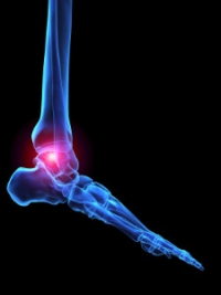 Systemic Sclerosis and Foot Health