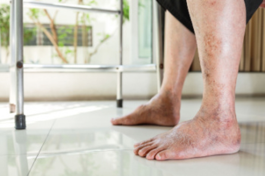Understanding Your Health Through Your Feet