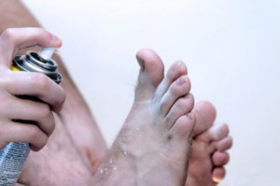 Signs and Causes of Athlete’s Foot