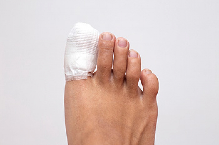 Toeing the Line on Toe Pain